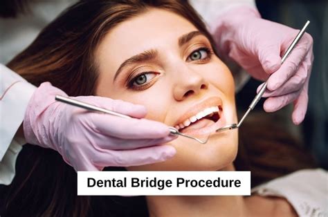 Dental Bridge Procedure: Comprehensive Guide & Benefits