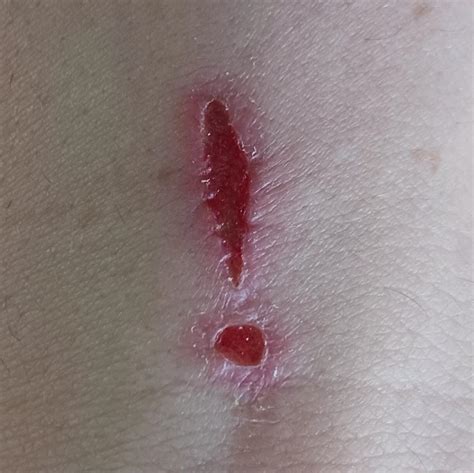 My Soldering Iron Burn Rmildlyinteresting