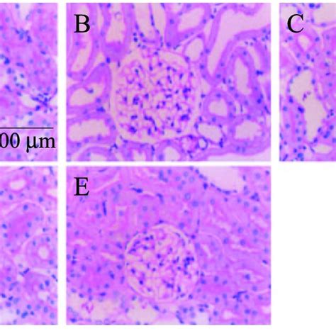 Representative Micrographs Of Immunostaining For Tgf β1 In Renal Tissue