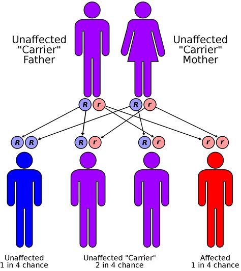 Microcytic Anemia - Causes, Symptoms, Treatment