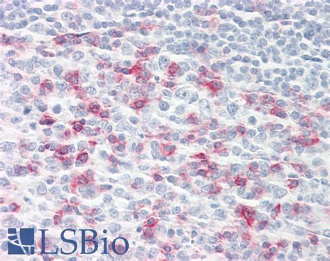 IHC Plus PDCD1 CD279 PD 1 Monoclonal Antibody Mouse LSBio