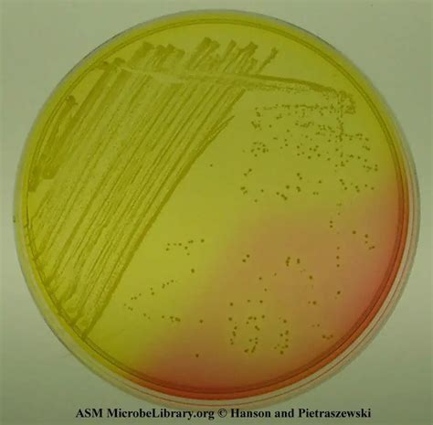 Mannitol Salt Agar: Principle, Uses, and Results • Microbe Online