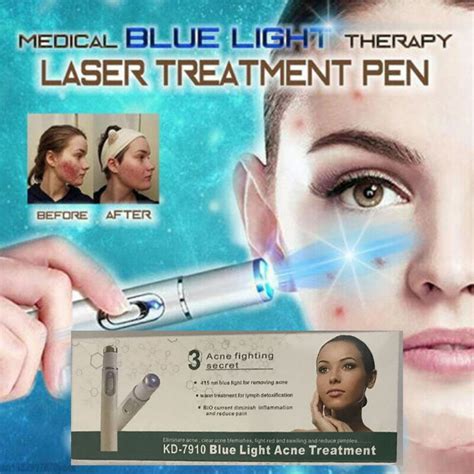 Caneta Laser Acne Port Til Para Remo O De Manchas De Pele Terapia De