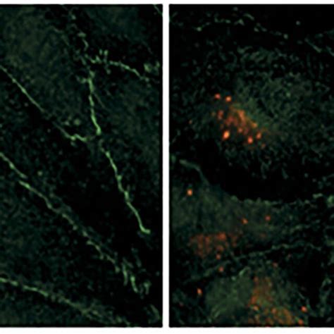 Hantavirus Infection Damages The Contacts Between Endothelial Cells