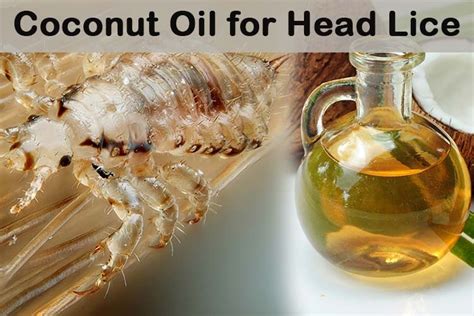 Coconut Oil For Head Lice