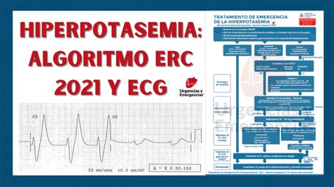 Hiperpotasemia Algoritmo ERC 2021 Y Electrocardiograma