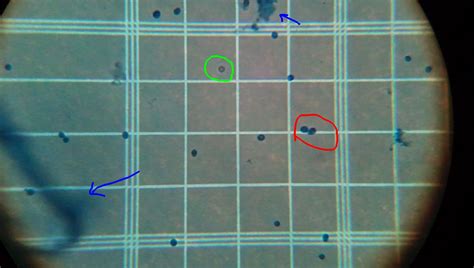 Woodland Brewing Research: Counting Yeast Cells to Assess Viability for ...