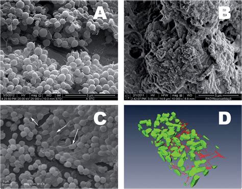 Scanning Electron Image Sem Of Biofilms A Conventional Sem