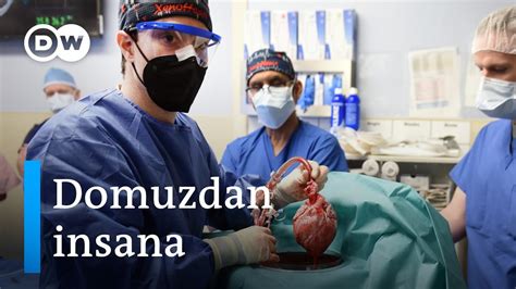 Domuzdan insana ilk kalp nakli Organları hazır halde bulundurmamız