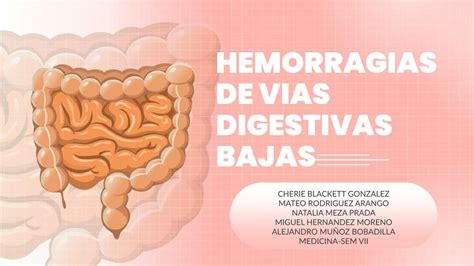 Hemorragias Digestivas Bajas Miguel Hernandez Udocz