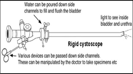 Is a cystoscopy painful - lasopatel