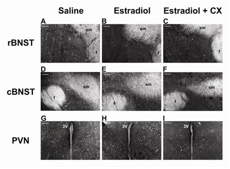 Photomicrographs From Short Day Mice Of C Fos Immunoreactivity In The