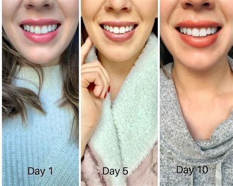 My Crest 3D Whitestrips Results And Complete Review Whitestrips