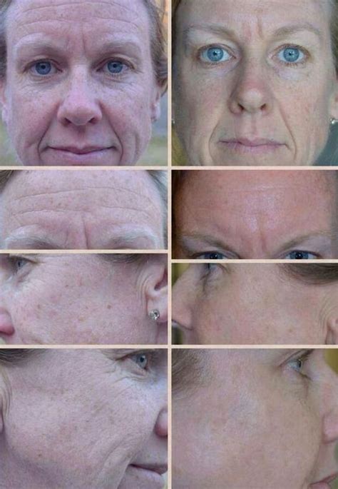 Exercising Facial Muscles For A Firmer Face: Face Aerobics Workouts ...