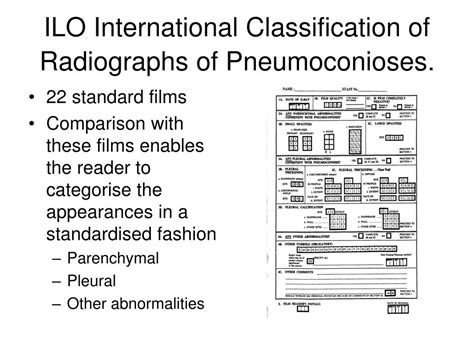 Ppt An Introduction To The Ilo Radiological Classification Of The