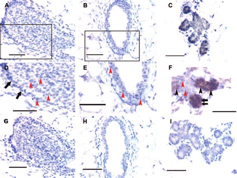 Immunoperoxidase Localization Of Prb At Different Stages Of Mammary