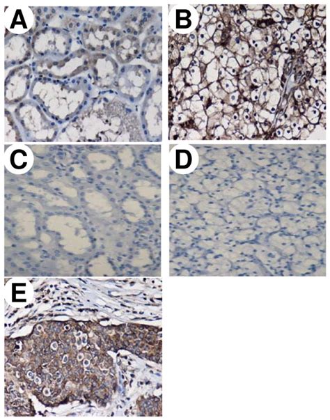 Immunohistochemical Staining Of Membranous EGFR In Normal Parenchymal