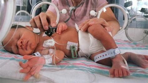 Premature Infant In Incubator