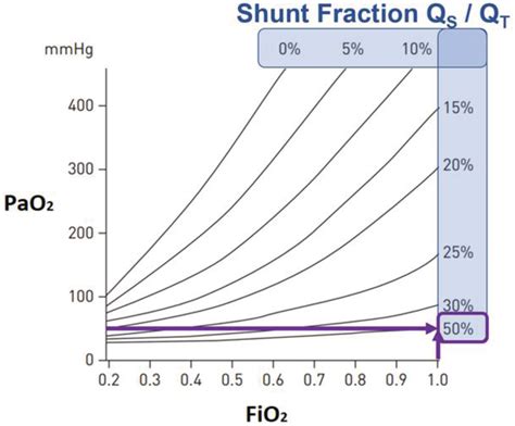 Iso‐shunt diagram, illustrating the relationship between PaO2 and FiO2 ...