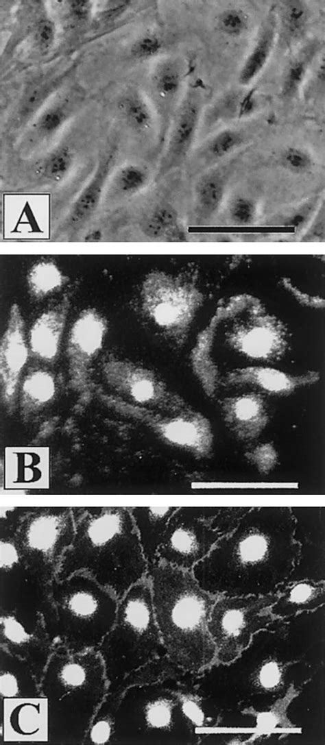 Characterization Of Adipose Tissue Derived MVEC A Phasecontrast