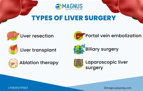 Best Liver Surgery In Chennai Advanced Technology