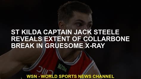 St Kilda Captain Jack Steele Reveals Extent Of Collarbone Break In