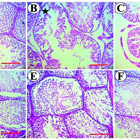 Photomicrograph Of Testicular Tissue In The Control Diabetic And