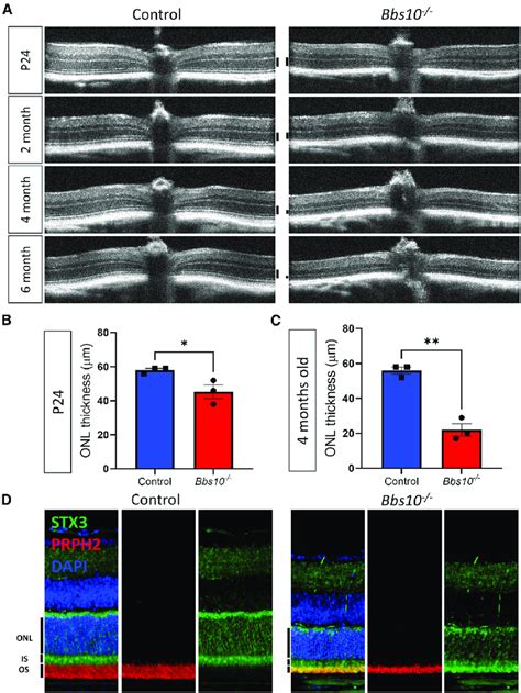 Progression Of Retinal Degeneration In Untreated Bbs10 Mice Bbs10