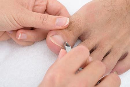 Podiatrists Housecalls In Chicago Chicago Home Foot Care