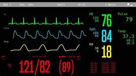 Easy 17 Cara Membaca Layar Monitor Icu Dengan Mudah 2023