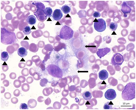 What Is Histiocytic Sarcoma Dogs