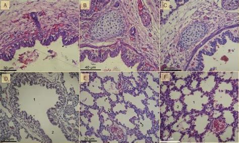 Fotomicrografia De Pulmão De Neonato Canino A Brônquios Nota Se Em