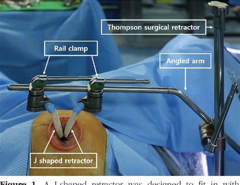 Figure From Comparison Of General Anesthesia And Combined Spinal And