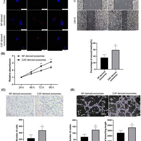 CAFderived Exosomes Promote Lymphangiogenesis In Vitro A Exosomes