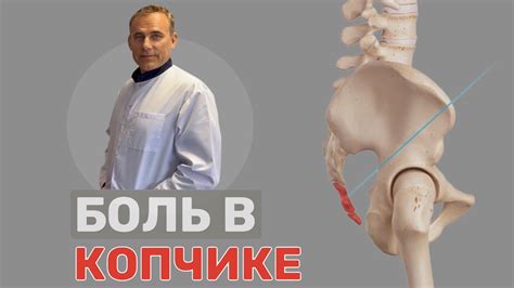 БОЛЬ В КОПЧИКЕ. Профессиональный теннисист. - YouTube