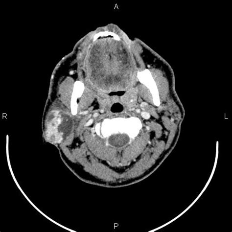 Image Radiopaedia Org