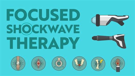 Focused Shockwave Therapy What Is It How Can It Help YouTube