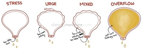 Surgery | Sketchy Medicine | Page 2 | Urinary incontinence ...