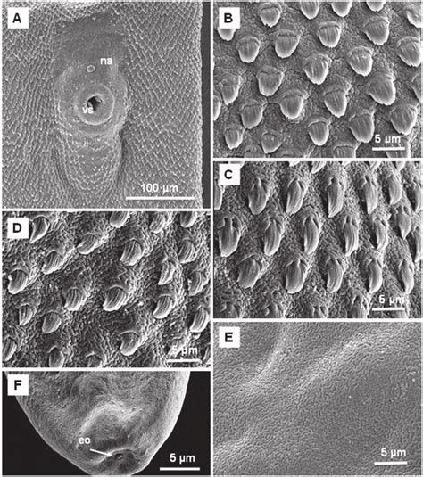 SEM Of Ventral Surface Of Adult A Impletum A Naked Area Around And