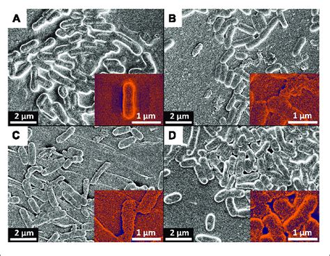 Scanning Electron Microscopy SEM Of Listeria Monocytogenes Biofilms