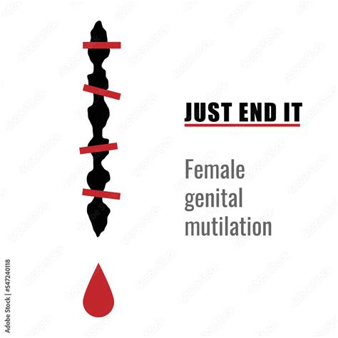 Zero Tolerance For Female Genital Mutilation Stop Female Genital