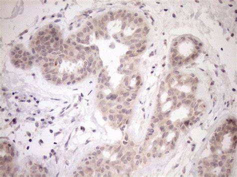 PARG Monoclonal Antibody (OTI6F4) (TA808614)