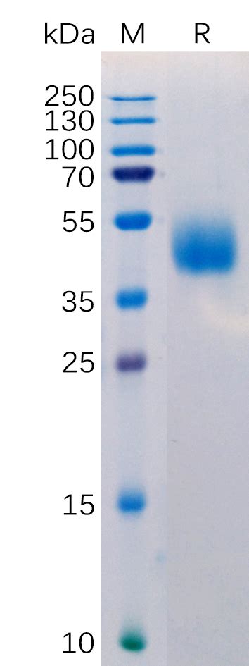 Human MICB Protein His Tag 专注肿瘤免疫