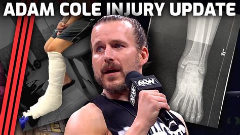 Adam Cole Reveals Broken Ankle Injury Will Miss Aew Wrestledream Youtube