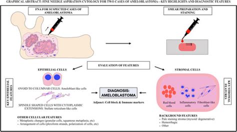 Fine Needle Aspiration Cytology For Two Cases Of Ameloblastomakey