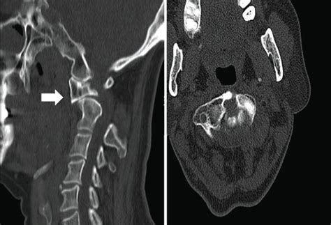 Case Presentation A Year Old Female Patient Presented With A