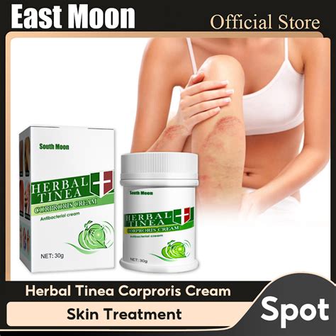 South Moon Herbal Tinea Corporis Anti Itch Cream Dry Itchy Sensitive