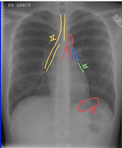 Physiology Block 5 Flashcards Quizlet