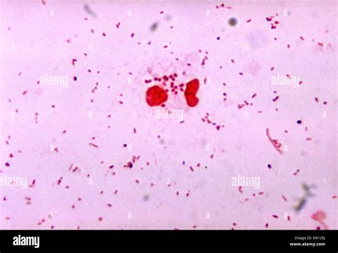 Neisseria Gonorrea Gramnegativa Fotograf As E Im Genes De Alta