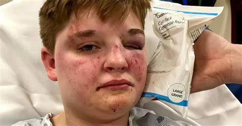 Lesbian Teen Brutally Beaten At Illinois McDonald S